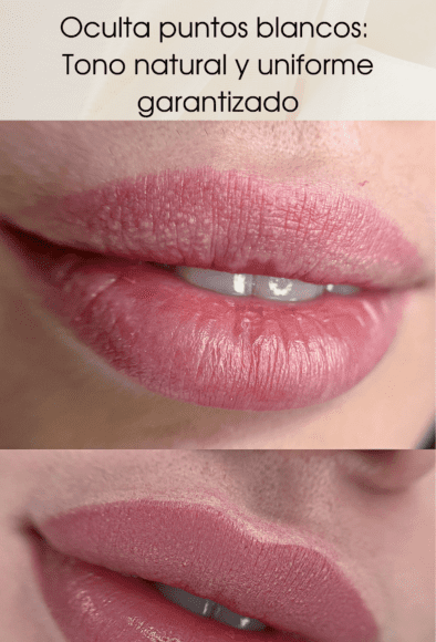 Oculta puntos blancos con micropigmentación