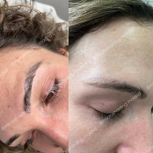 Le realizaron microblading
